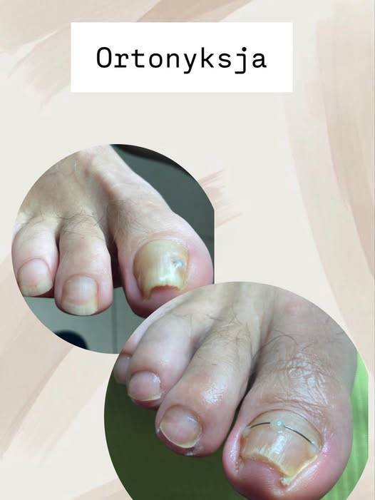ortonycja